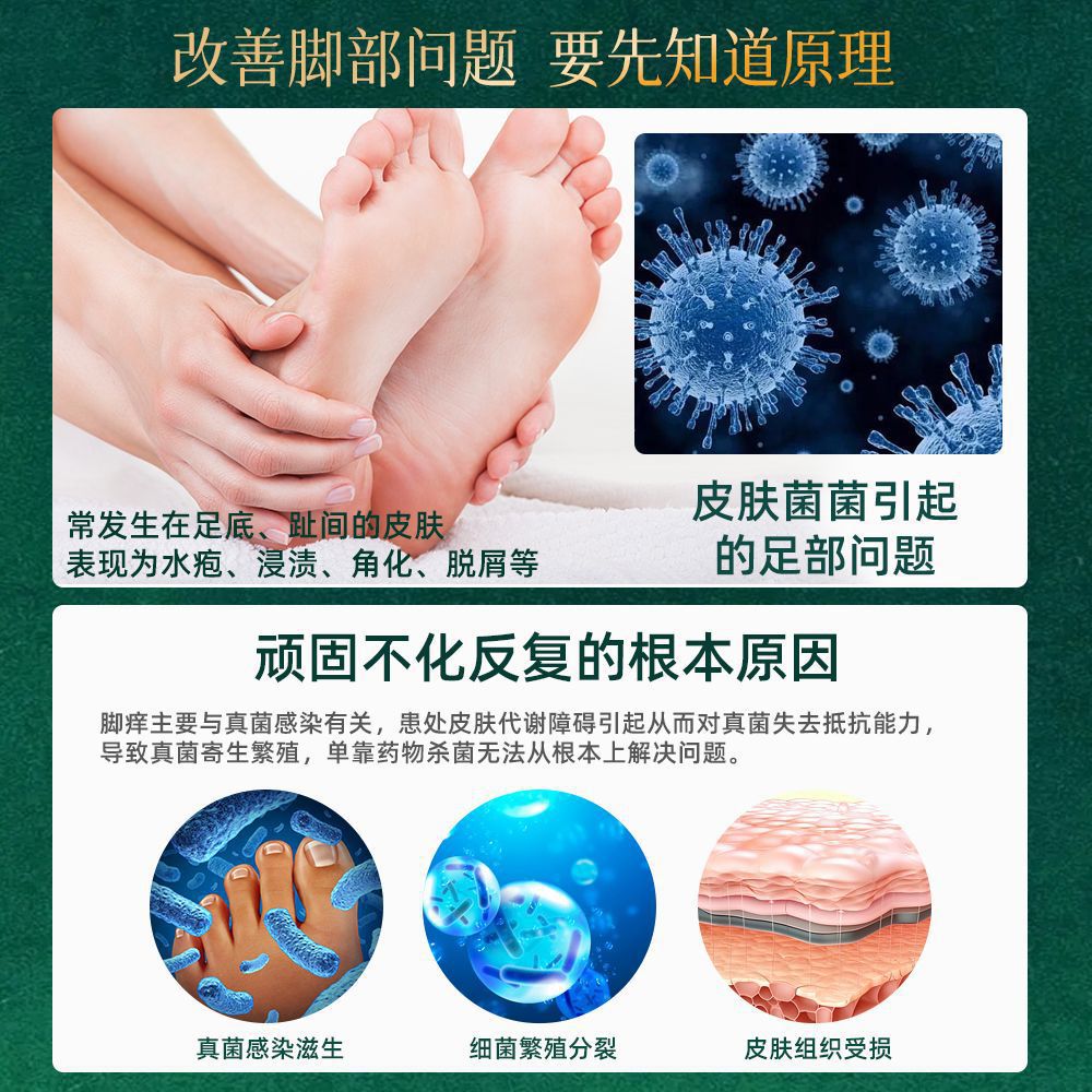 Micronidron polipéptido herbal inhibidor de bacterias spray antiprurito spray fabricante de cuidado de pies