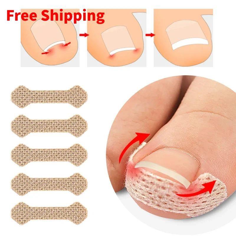 10Pcs/20Pcs/30Pcs Ingrown Toenail Correction Sticker Adhesiv