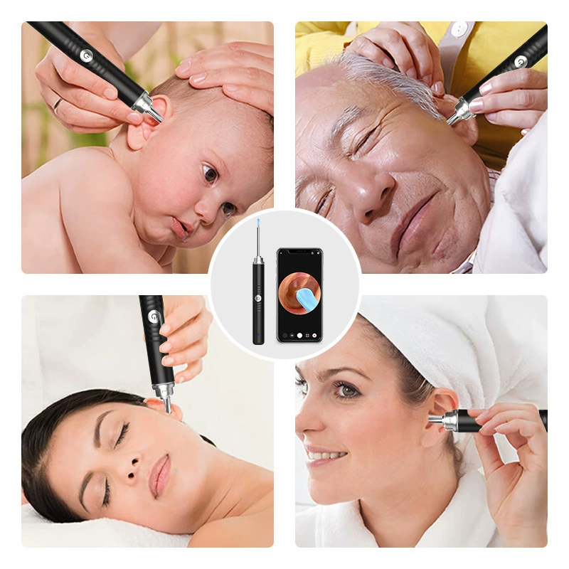 Умная ложка для ушей с подсветкой, водонепроницаемая с видеокамерой наблюдения