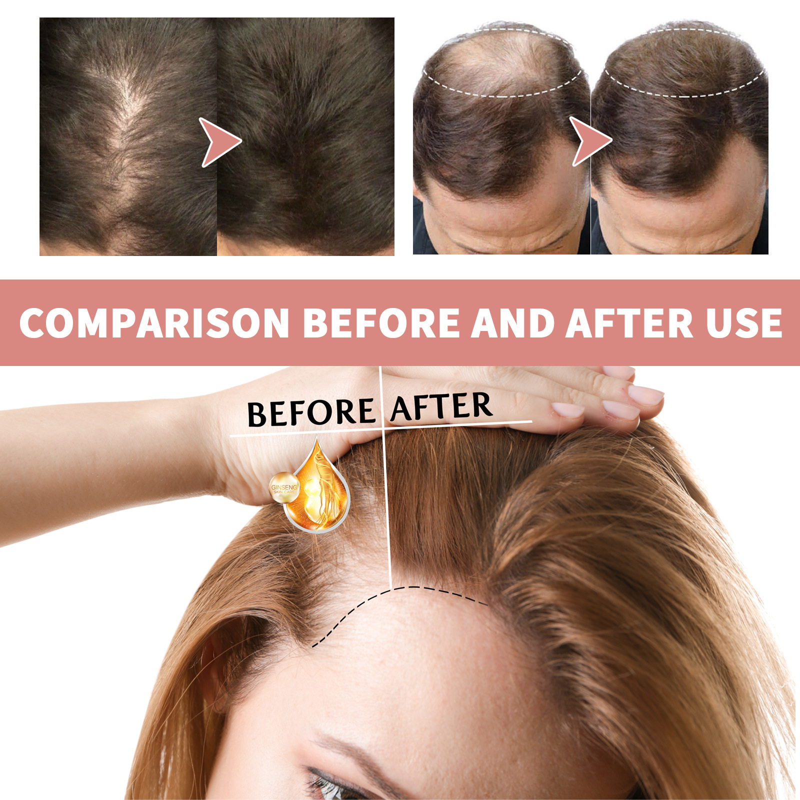 Anping EELHOE Dense Bottle Denso, forte e resistente Cura del cuoio capelluto riparatore, antigoccia, liquido per massaggio alla radice dei capelli fisso,_voghion.com