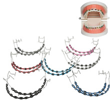 �羳���R�d ���ƿ�ǻ�����b� ��ͨ���������o�l��ǻ���X�в�ģ��