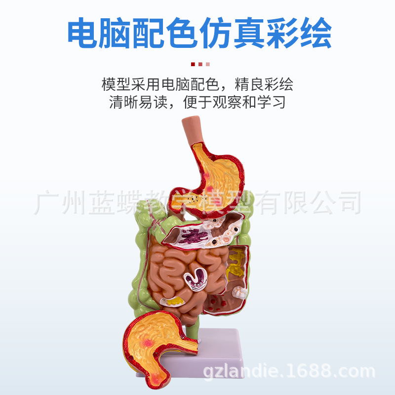 ������θģ������θ�봩�ײ�̬θģ��������θ��״�����������