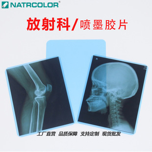 ������{��X��Ƭ��ī�zƬ8*10��ʽӰ���z��DR/CT�S���t�ø�ʽ�zƬ