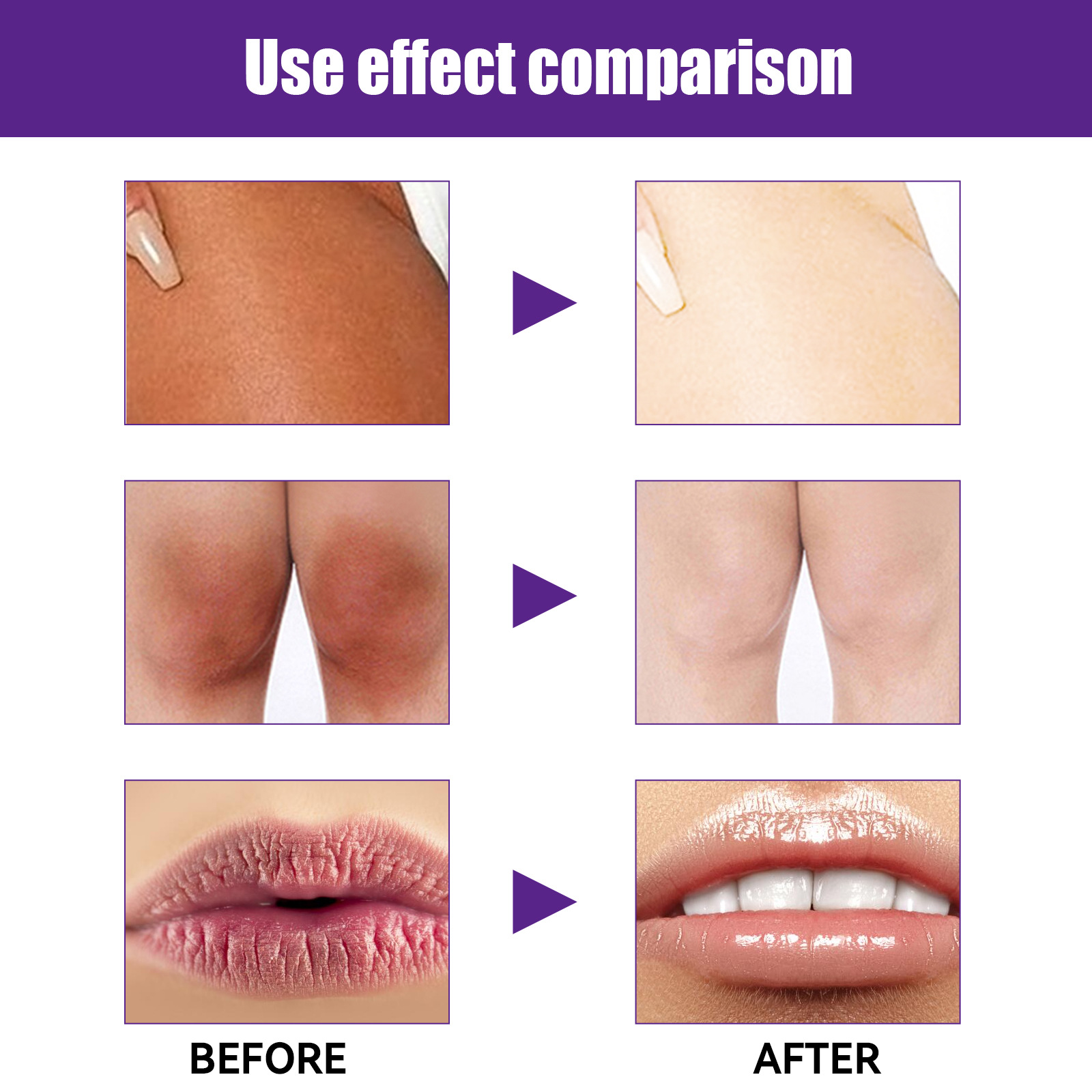 EELHOE Natural Brightening Moisturizing Cream Firms Skin, reduces melanin in the lips underarm joints, and_voghion.com