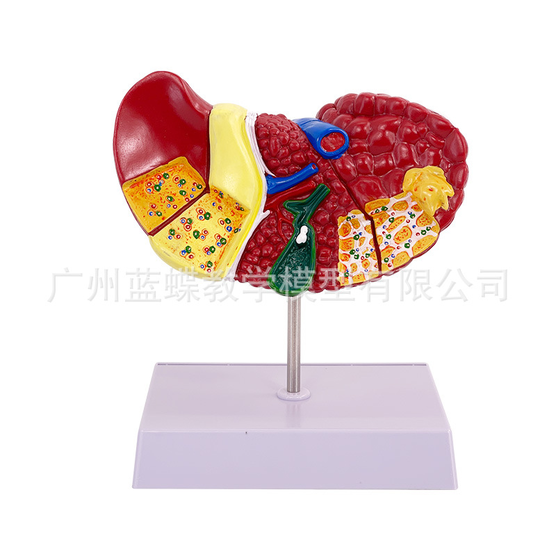 ��ɫ����ģ�ͳ����ٴ���������ҽ����ҽ����ͨӲ��֬���׸ε��ڿ�