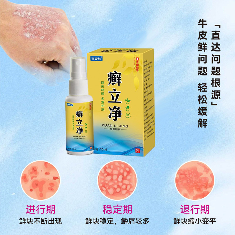 日本製牛苔王牛皮軟膏、頭皮・頭皮のフケ対策、皮膚殺菌、かゆみ止め、本物の特殊牛皮軟膏|undefined