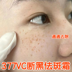 377vc断黒霜美若白去化斑強効去暗黄黒色素黄褐斑淡化色斑コントロールクリーム
