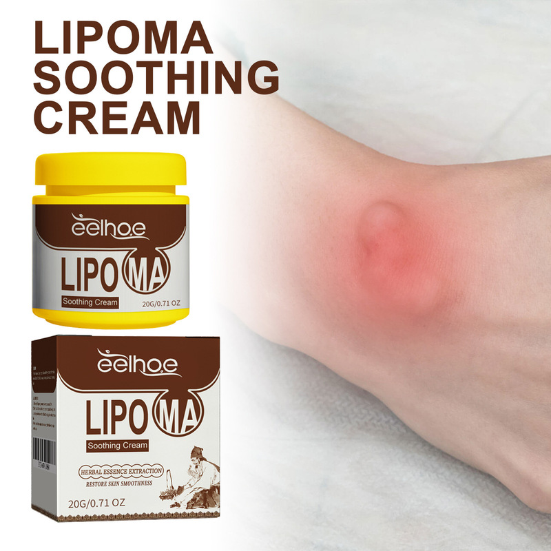 EELHOE fat knot repair cream to relieve body fat caking subcutaneous lumps body health care cream