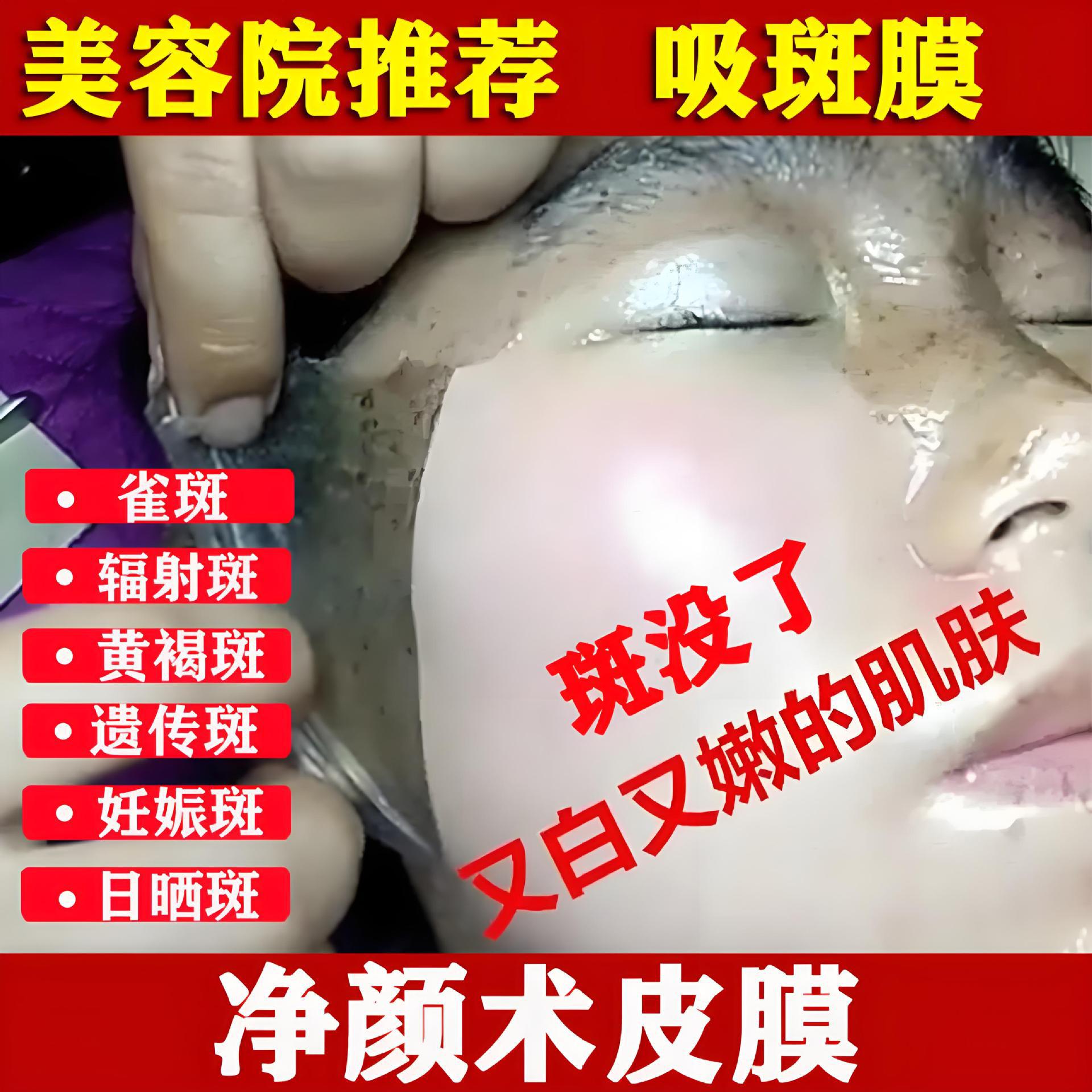 Herbal Cleansing Mask for Facial Sun Spots, Chloasma, Freckles, Age Spots, Beauty Salon Peel-Off Five-Day Suction Mask