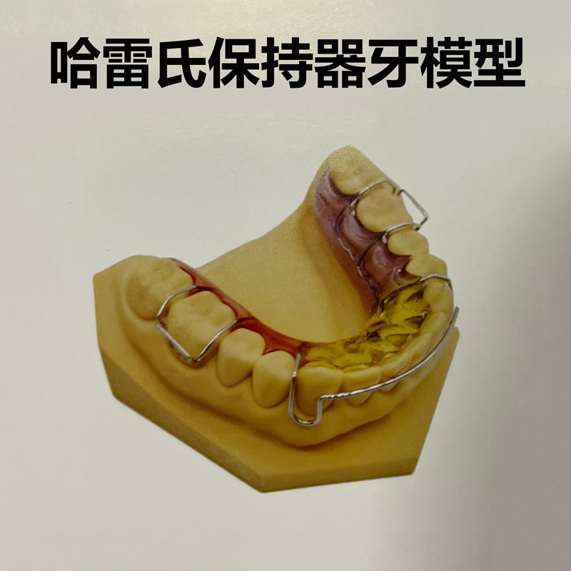 儿童功能性矫治器模型环绕保持器哈雷氏保持器上颌平面导板阻萌器