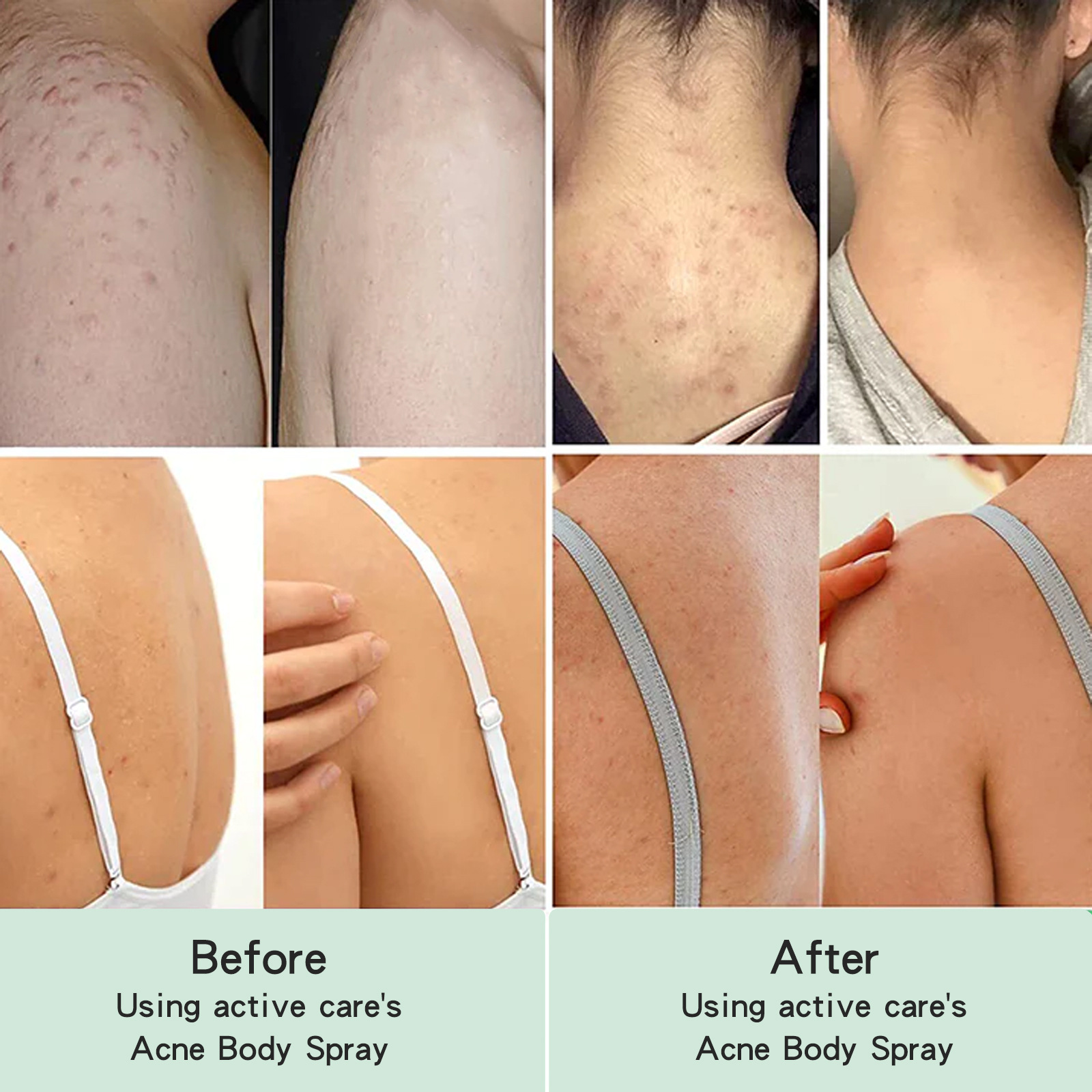 EELHOE repair reduces acne marks, cleans back, smoothes skin, and moisturizes spray_voghion.com