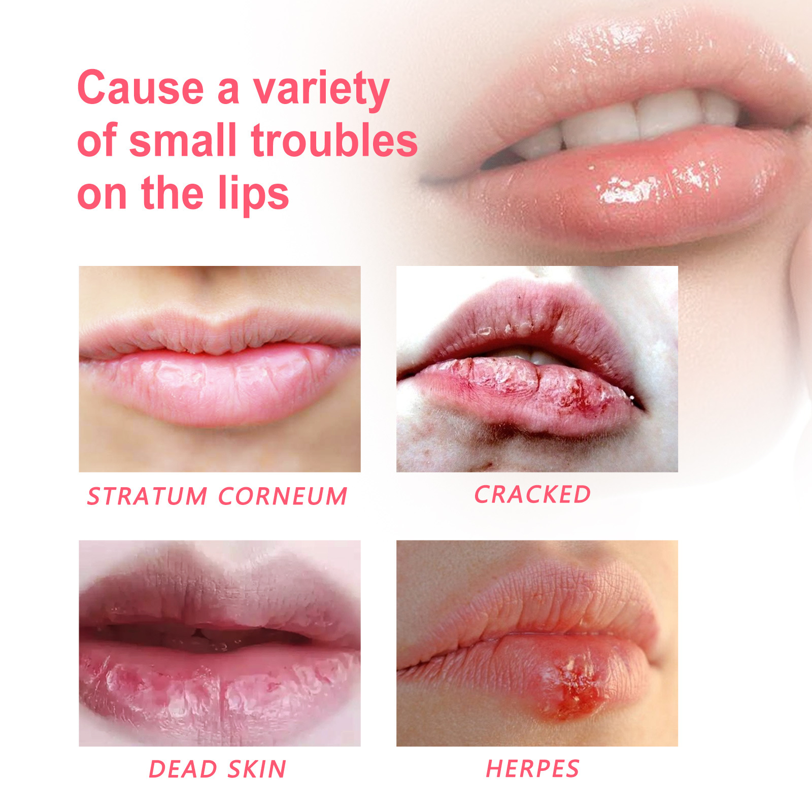 EELHOE hydrate, répare les peaux mortes, prévient les fissures sèches et soigne en douceur l'huile pour les lèvres_voghion.com