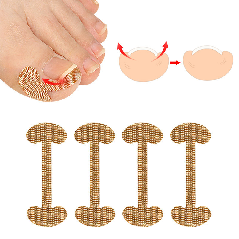 Nail cotton toenail nail groove nail inlay nail device thumb nail patch fast toenail repair deformation meat bag