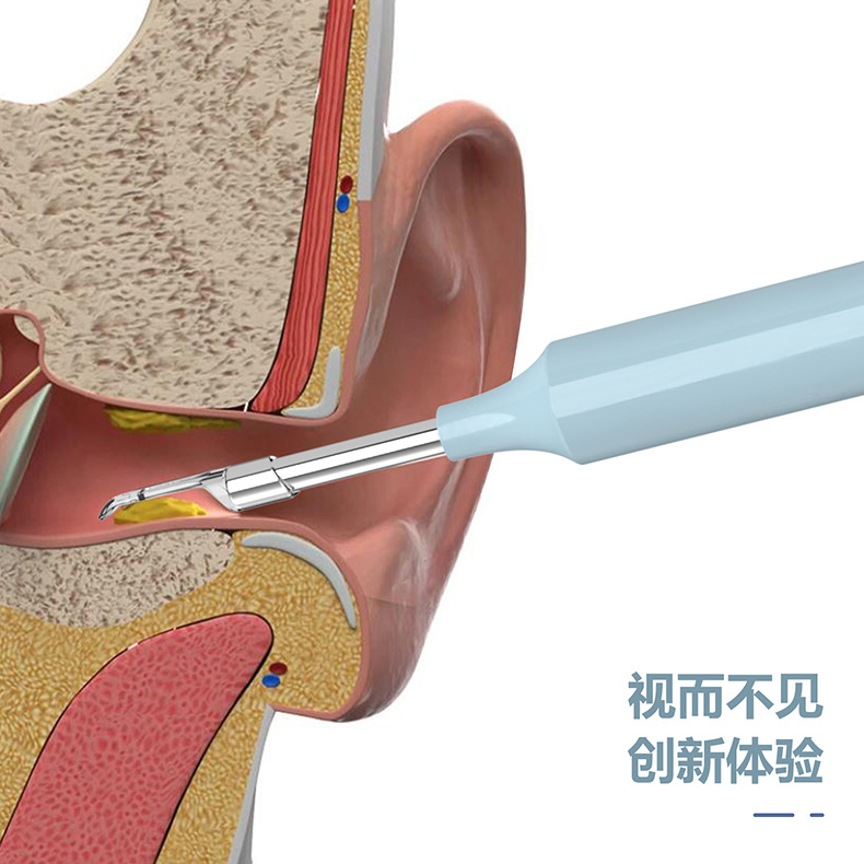 Wireless WiFi Otoscope 1080P HD Ear Camera