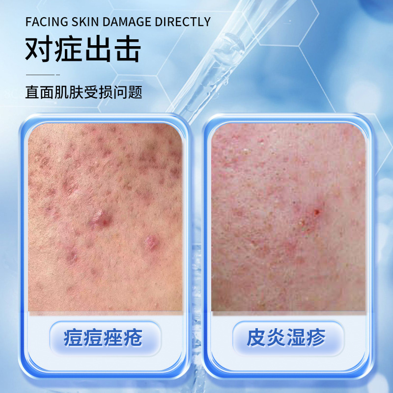 ひまわり医療スキンケア軟膏、敏感肌、赤み、皮膚炎、湿疹、ニキビ除去、ニキビ跡除去ジェル|undefined