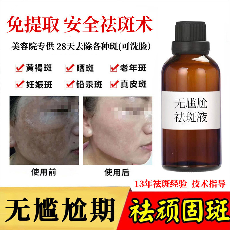 无尴尬期祛斑液去斑液全套排色液免提取不结痂美容院分解色素液|undefined