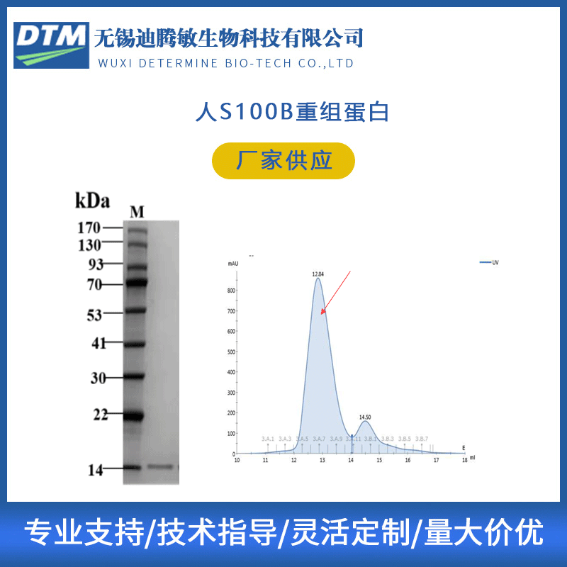 Purifying people S100B recombinant protein protein Content test reagent Ditengmin