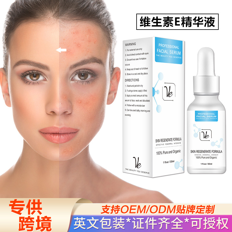 Cross-border exclusive Vitamin E facial serum, brightens skin tone, 30ml.