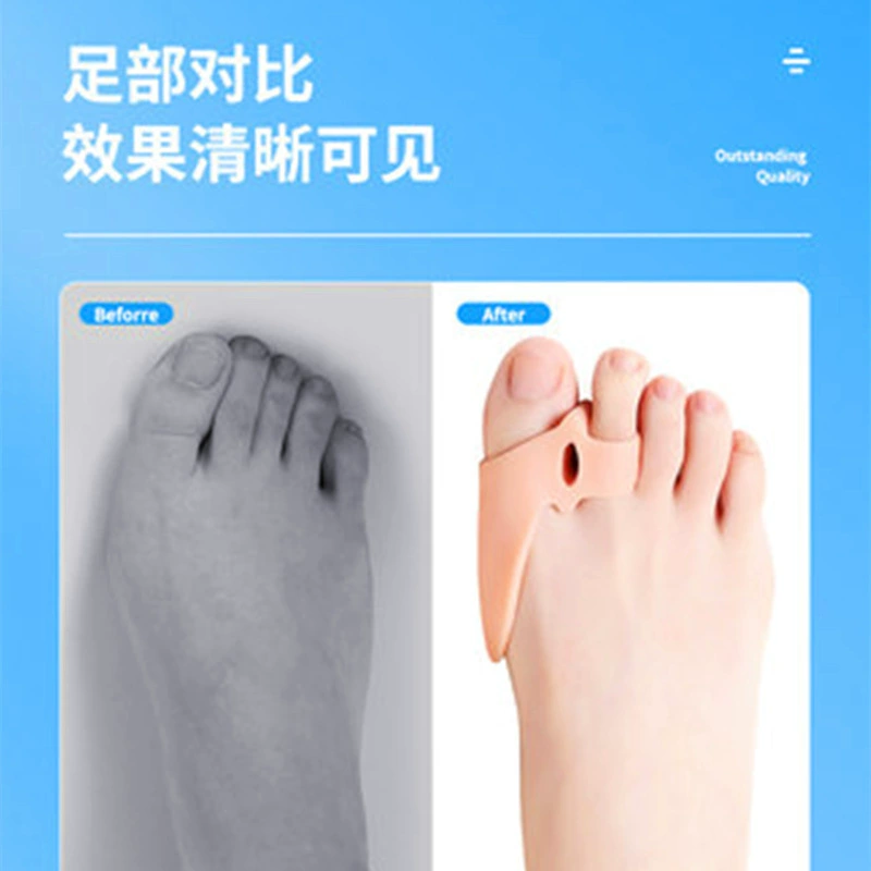 Silicone breathable elastic orthotics for toes
