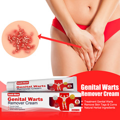 South Moon Pinghou Youke Wart Cream, Wart Cream, Hands, Feet, Face, Armpits, Neck, Filamentary Suppression of Warts