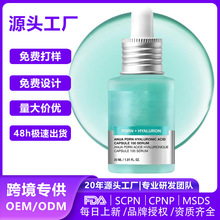 ��Դ�^���S��͸���|���z���ݹ⟨�l�沿���AҺ͸���|�ᱣ�����Һ