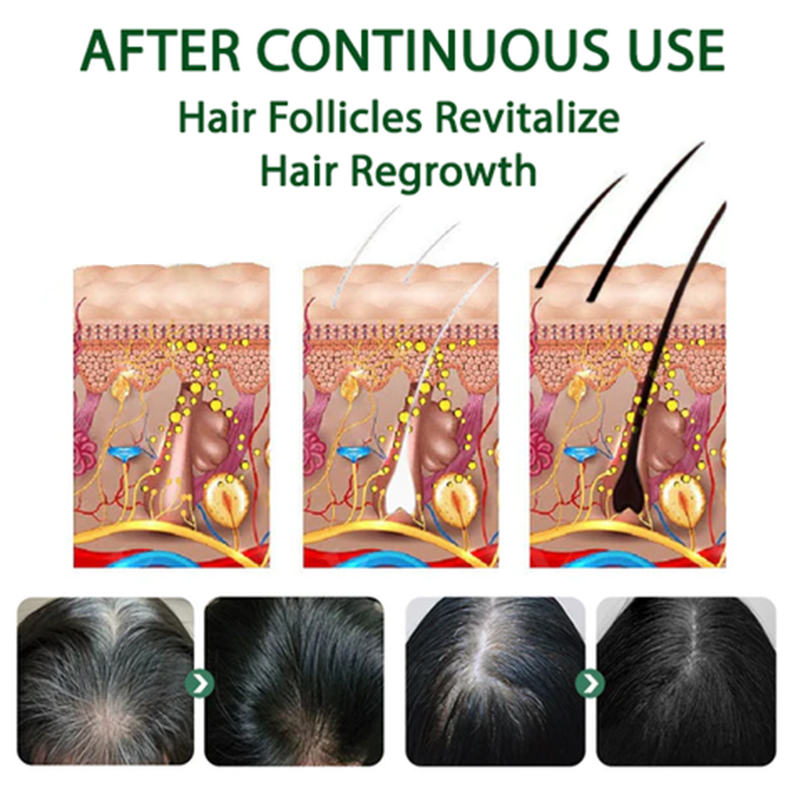 EELHOE Black Hair Spray Thick, nourishing hair roots, shiny and smooth natural black hair covering white hair hair care spray_voghion.com