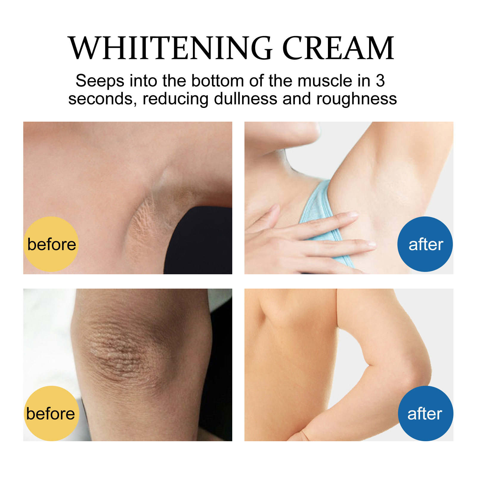 EELHOE belilna krema za posvetlitev sklepov pod pazduho, mehčanje kože, vlaženje, beljenje in_voghion.com