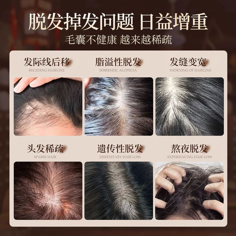 纯手工熬制侧柏叶洗发水无硅油植物养发去屑止痒控油草本温和清洁|undefined
