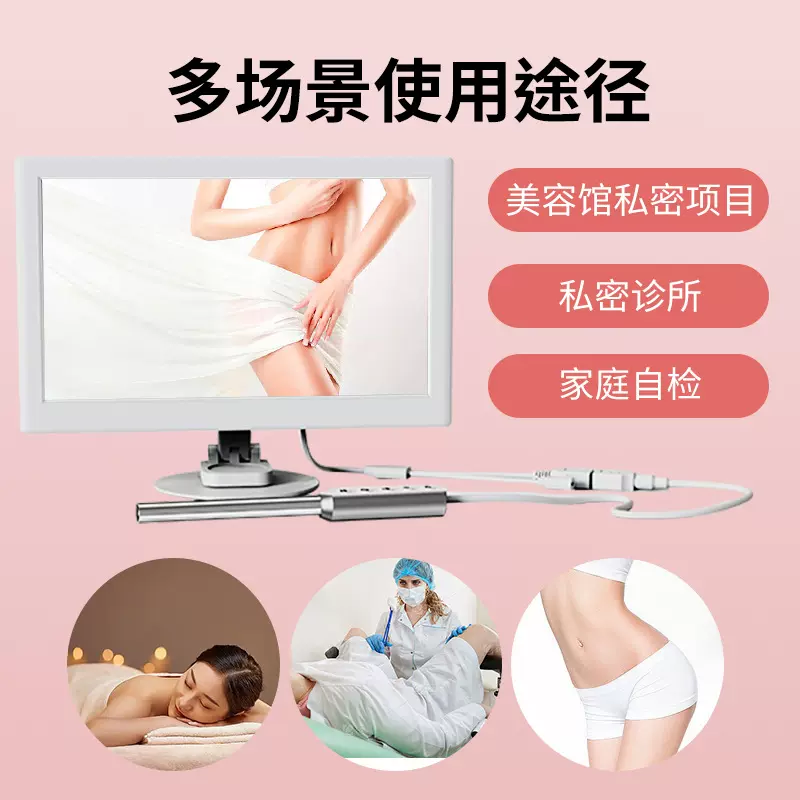 妇科私密检查阴道内窥镜宫颈仪器阴道镜1000万高清像素拍照录像