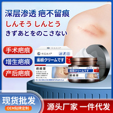 ���������̺����ñ��������g�����a��C���̺۲��m�TĨ���S�����l