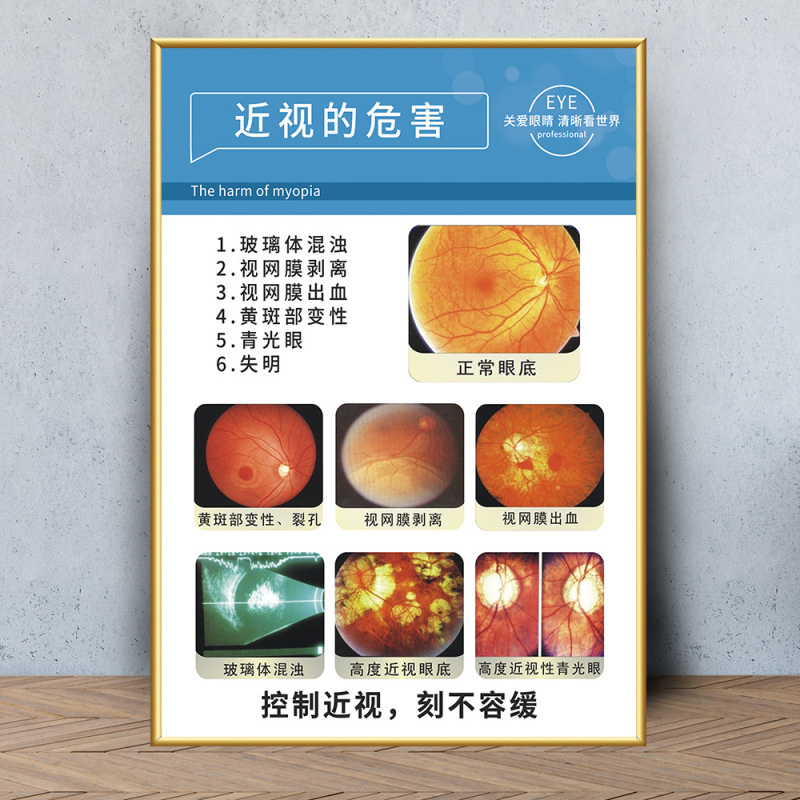 眼鏡店の壁面装飾画眼科病院は目の構造を描いています。|undefined