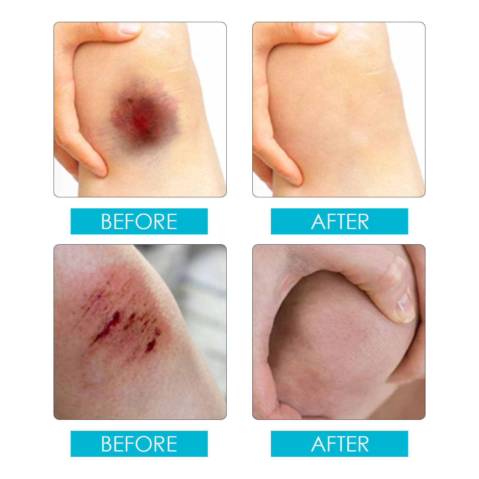 Jayswing waterproof band aid breathable transparent spray wound patch protective film liquid dressing_voghion.com