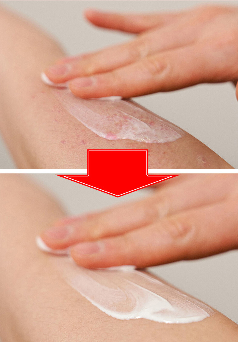 Shennong Baiyang Wang Herbal Ointment 20g External Topical Balm for Traditional Herbal Care in use