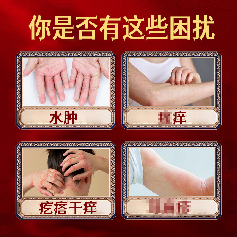 藏巴旗制药皮肤瘙痒膏炉甘石荨麻止痒专用成人痱子防淹脖子工厂直|undefined