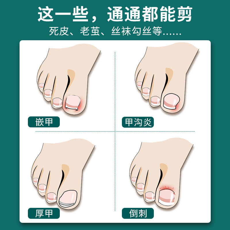 Alergar regalos de corte de uñas de la unidad de corte de uñas de la unidad de corte de uñas de la unidad