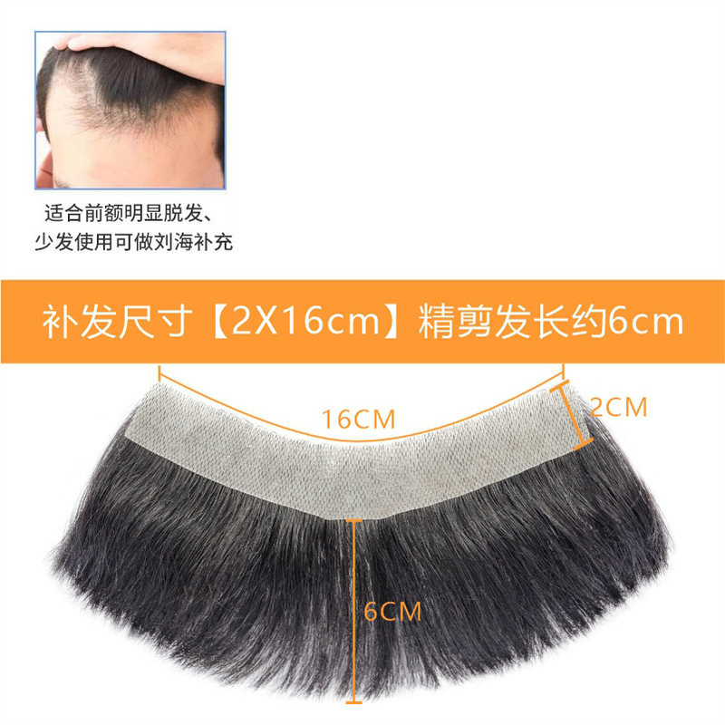发际线假发贴假刘海假发片m形发际线贴男一片式前额补发自然真发|undefined