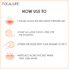 Focallure transparent day and night acne stickers FA186 (only for export, procurement and distribution, do not sell for individuals)