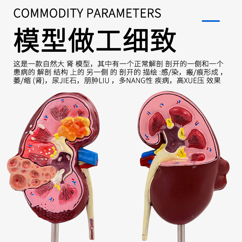 ����������ģ��,��������ģ�� ����ģ�� �����������ٽ���ģ��