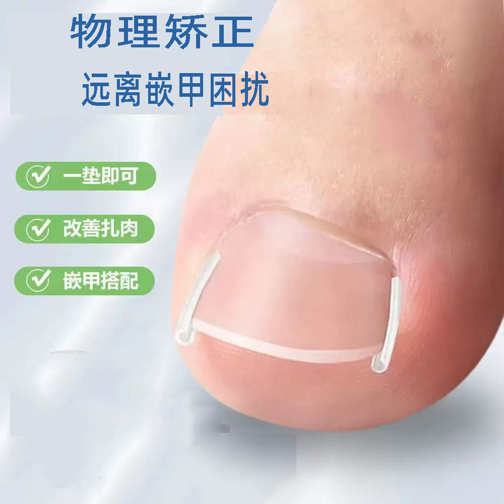 指甲隔离垫嵌甲垫填充垫片矫正器贴正甲贴指甲脚趾甲长肉