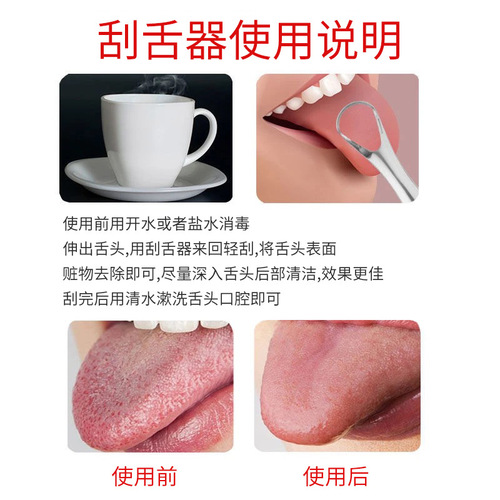 Stainless steel tongue scraper, oral tongue scraper, adult bad breath tongue scraper, U-shaped tongue scraper