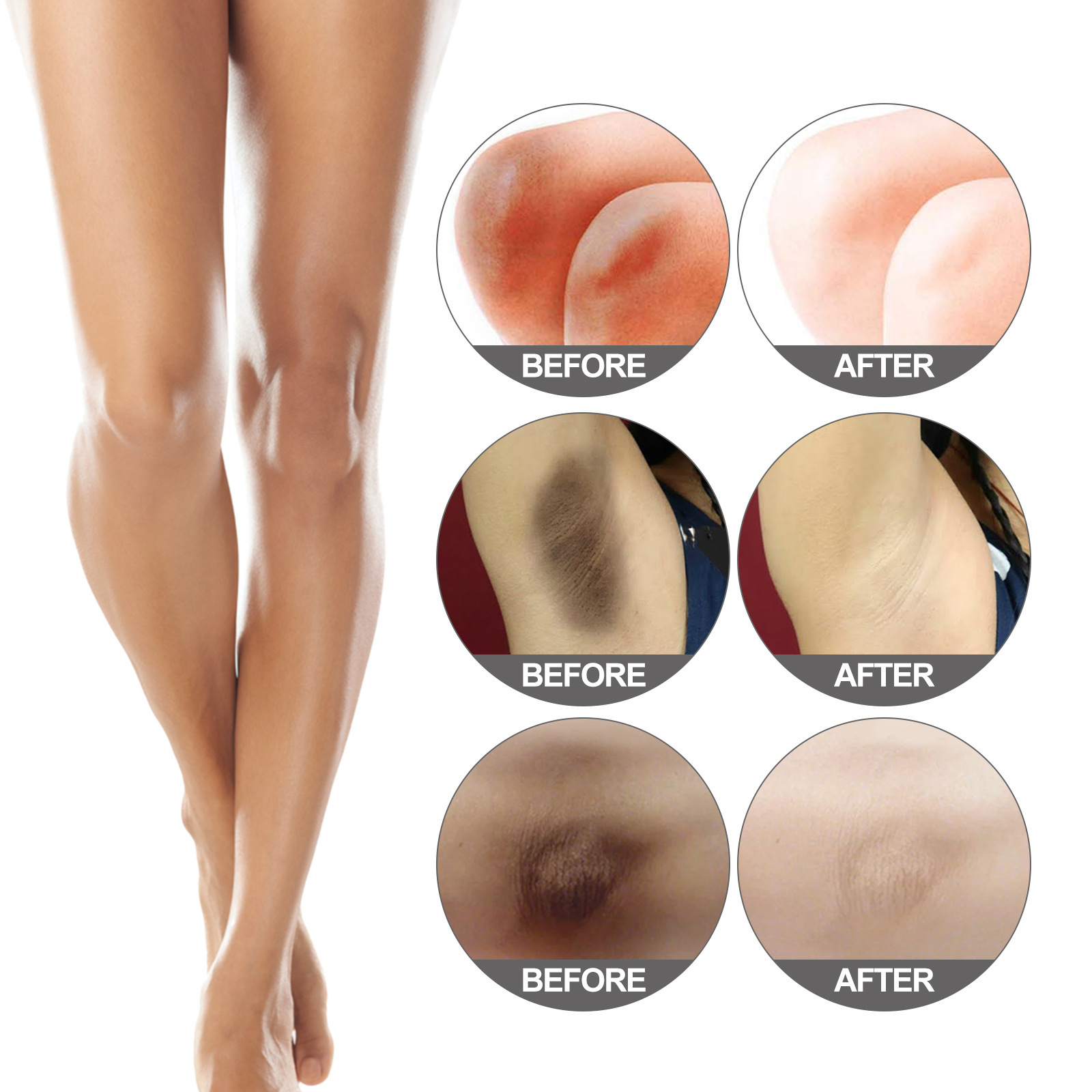 Jaysuing Whitening Cream for Repairing Underarm Thigh Joint Blackness, and Moisturizing Darkness,_voghion.com