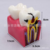 Dental teaching model doctor-patient communication model comprehensive case model removable dental model implant restoration model