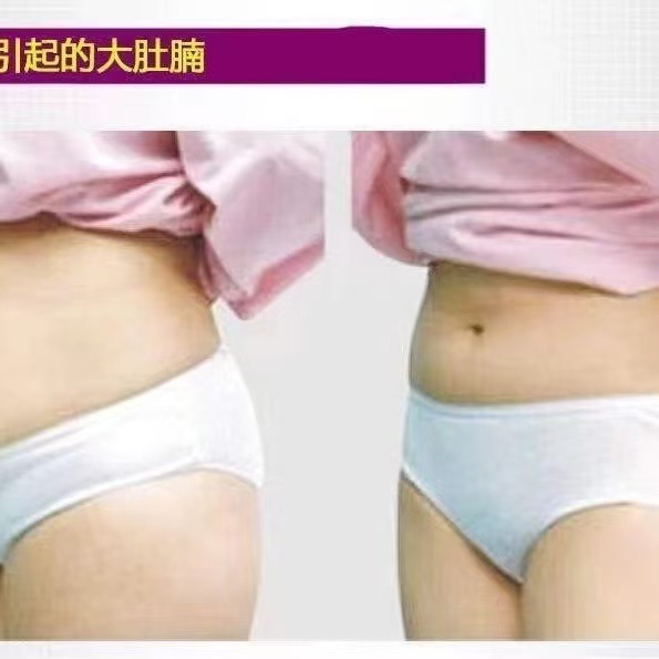 【新型唯蜜痩せ公式サイト正規品】VMESHOホットパック微商同タイプの維密痩せ型腰痩せベルト|undefined