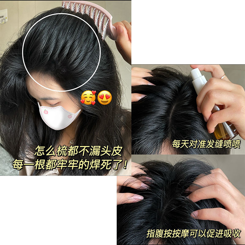 防脱生发液育发液精华液发际线增长头发猛长激活毛囊侧柏叶育发剂|undefined