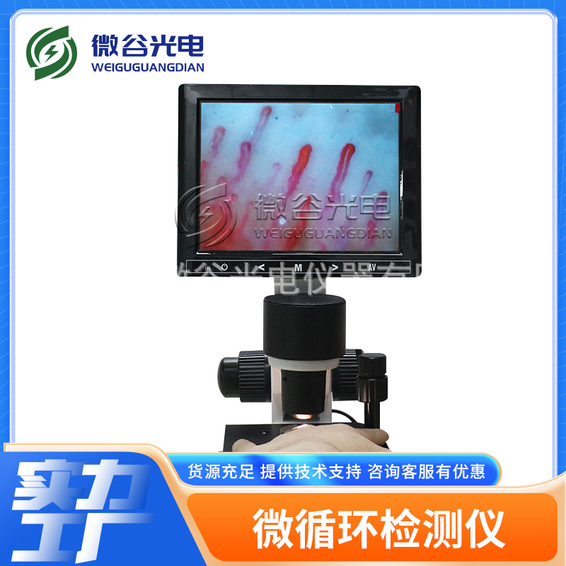 微谷甲襞微循环观察仪XW880 专业检测血管流速 无创性检测 性价比