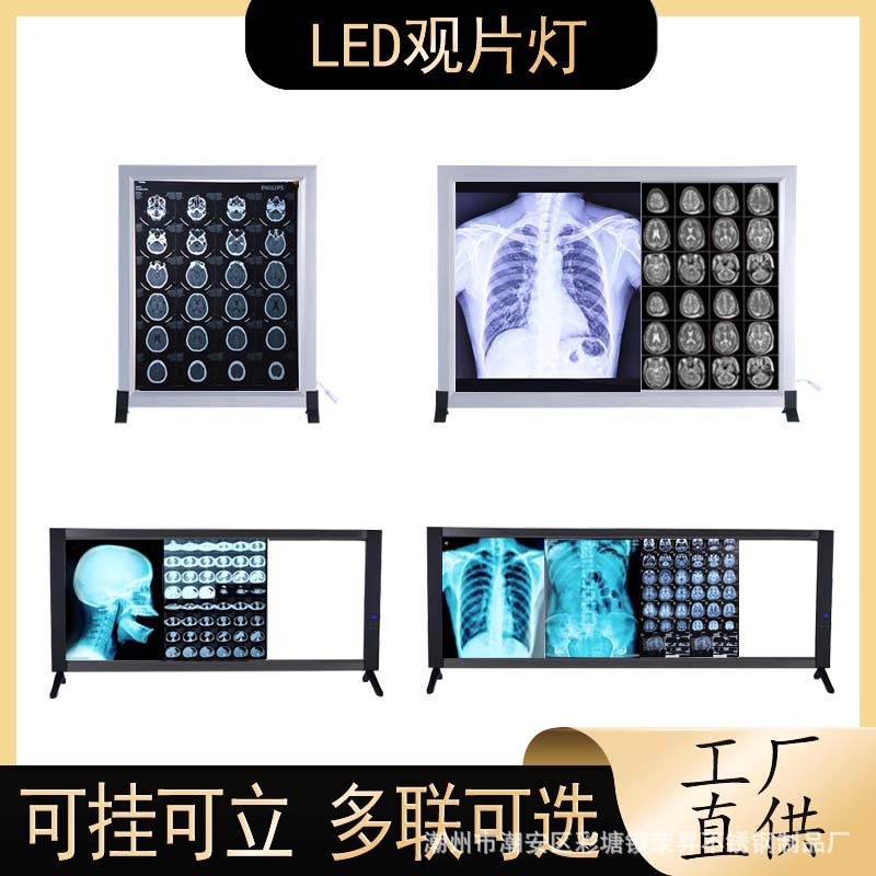 X光观片灯LED灯箱医学影像灯骨科单三联手术CT胶片阅片灯四联调光