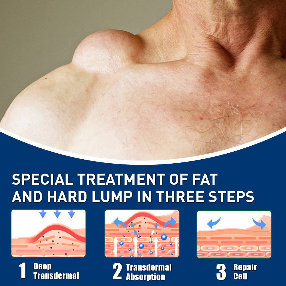 スミフン脂肪ケアクリーム 日本語脂肪粒外用マッサージクリーム AliExpress シャピーチャンネル越境 K10165