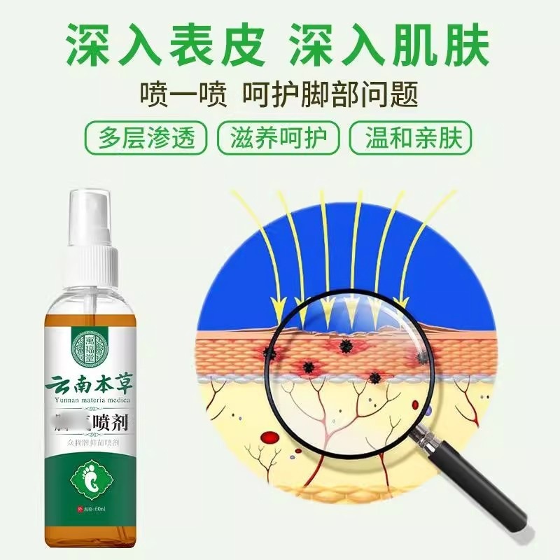 寓福堂云南本草脚喷雾抑菌止痒烂脚丫脚痒水泡脱皮脚臭喷雾|undefined