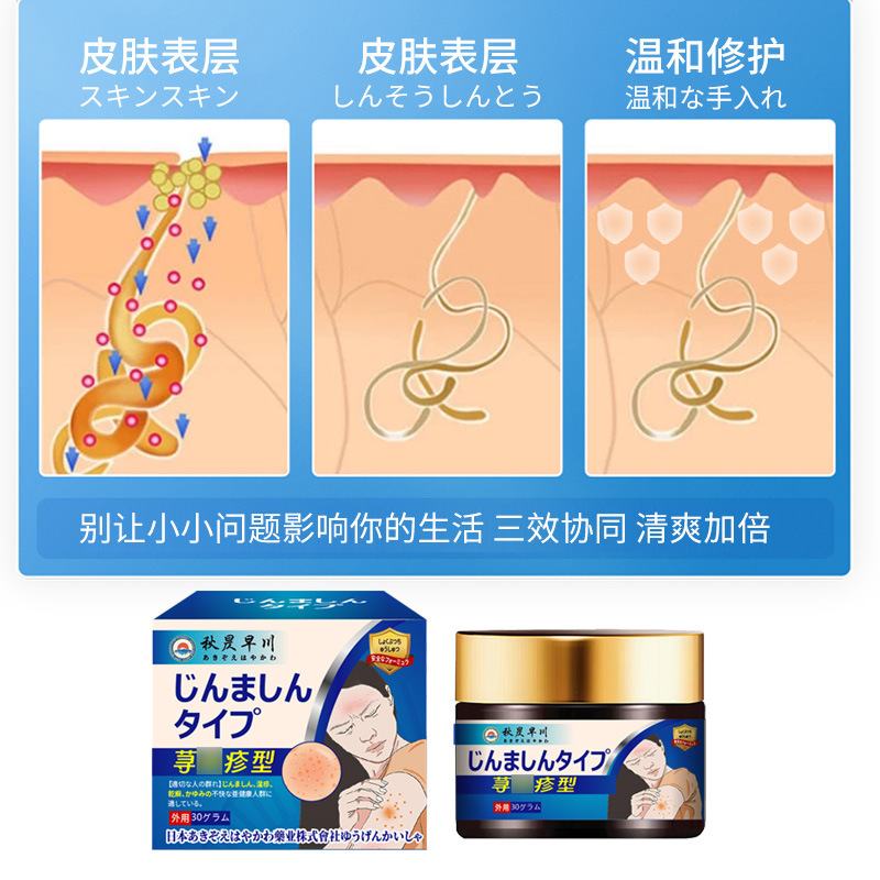 荨麻红疹皮肤保健膏皮肤不适起藓泛红湿痒外用护理涂抹膏工厂代发|undefined