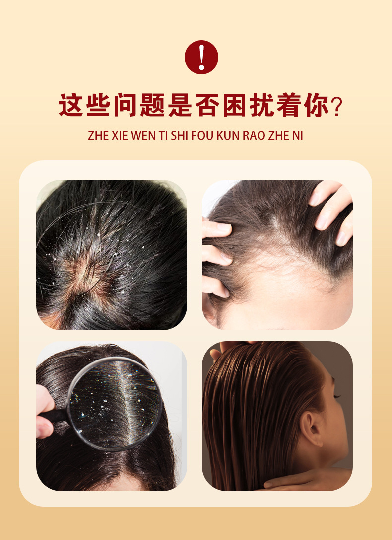 He Shou Wu Scalp Care Cream Herbal Head Skin Care for Oily Scalp 100g quality and texture